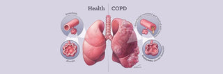 COPD <br> Chronic Obstructive Pulmonary Disease