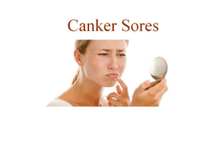 Canker Sores <br> Prevention and possible fast healing