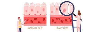 Leaky Gut Syndrome (LGS)