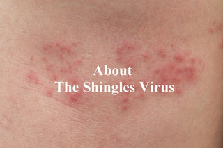 Shingles also known as herpes zoster